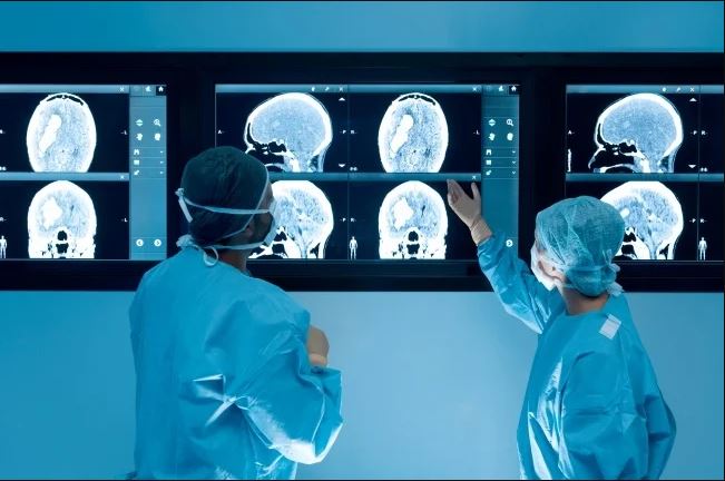 Covid-19 effect on brain