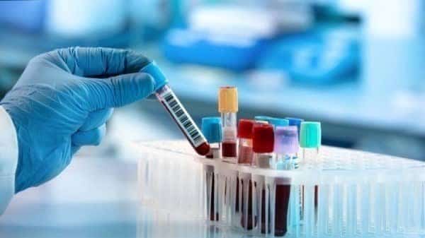 Laboratory workers