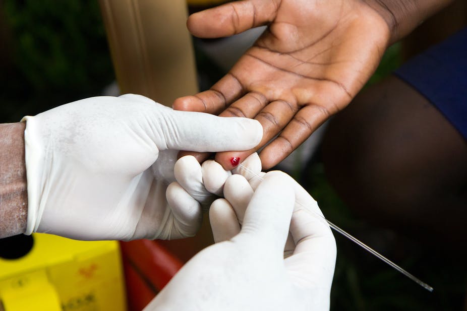 HIV testing