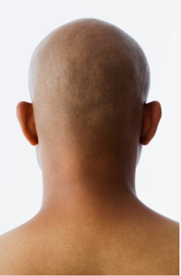 bald man