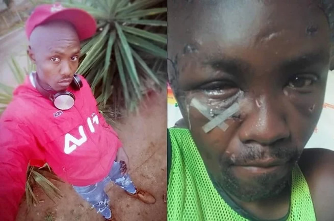 Hero man who was stabbed & left blind speaks out