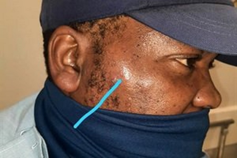 Police officer hospitalised after being beaten up at tavern