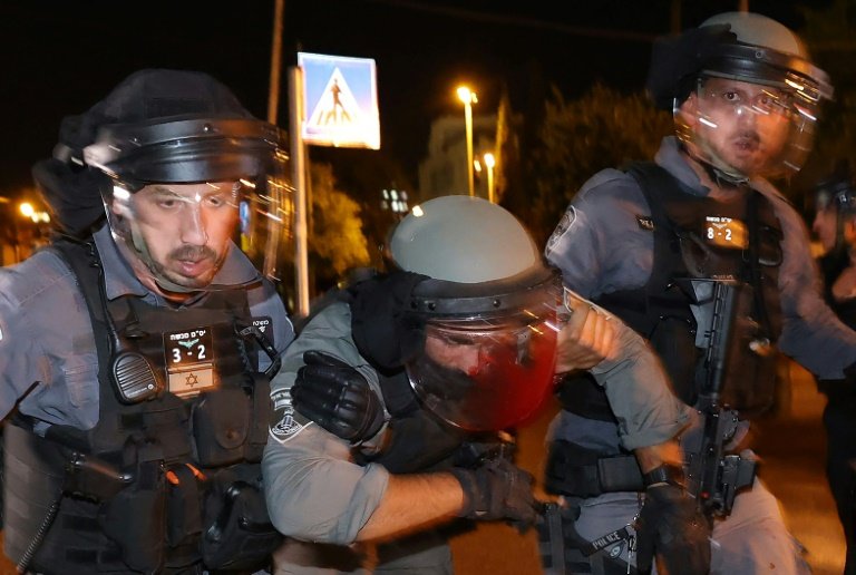 100s wounded in weekend of east Jerusalem violence