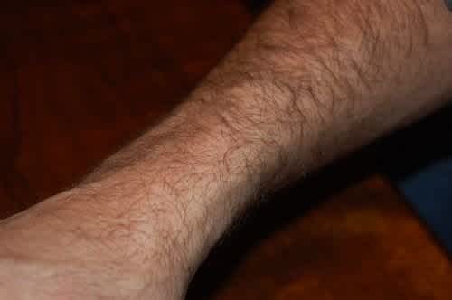 hairy