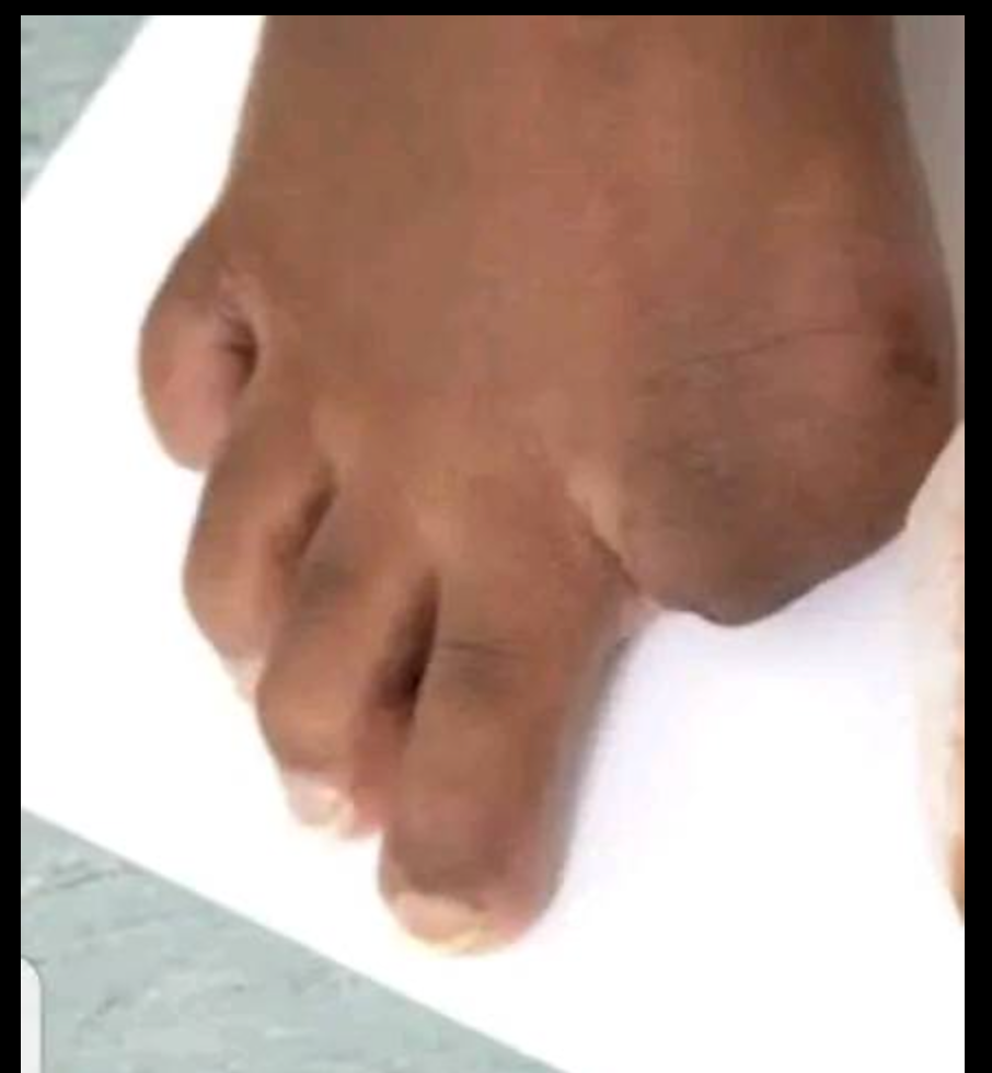 Selling your toes in Harare