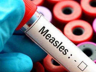 Measles cases