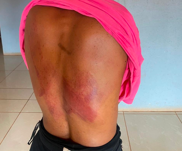Teacher remanded in custody after allegedly assaulting female learner in Limpopo