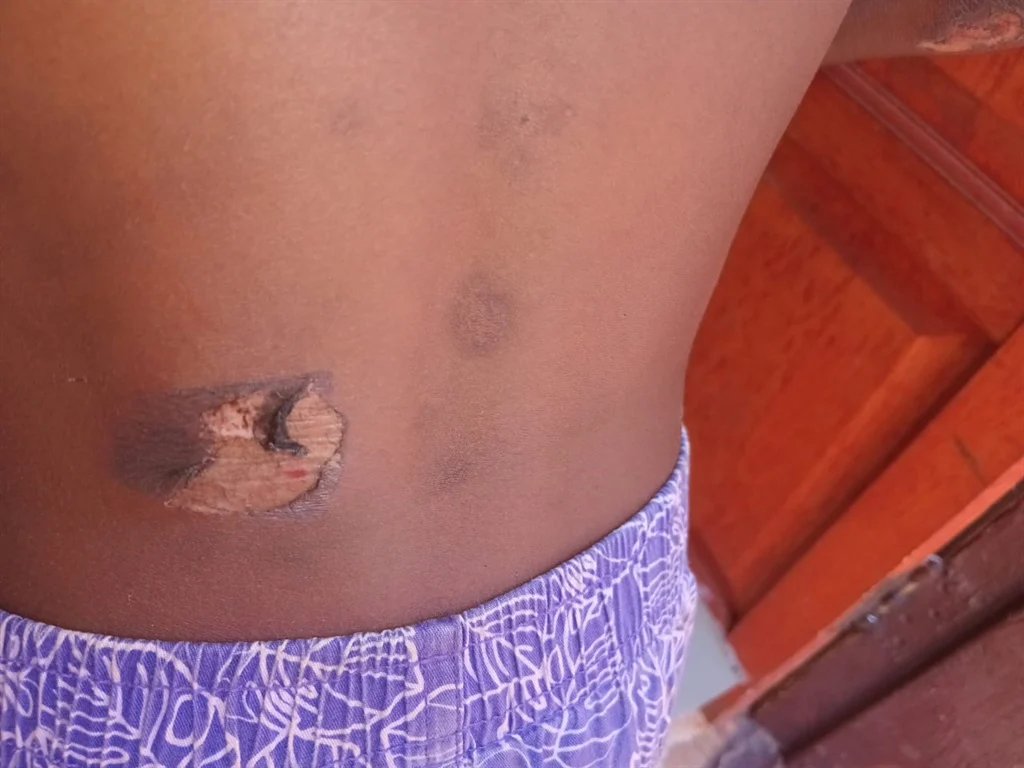 4-year-old beaten over R1500
